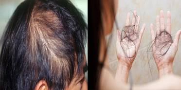 Hair care tips telugu for male and female